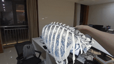Deploying MR to surgical Robot
